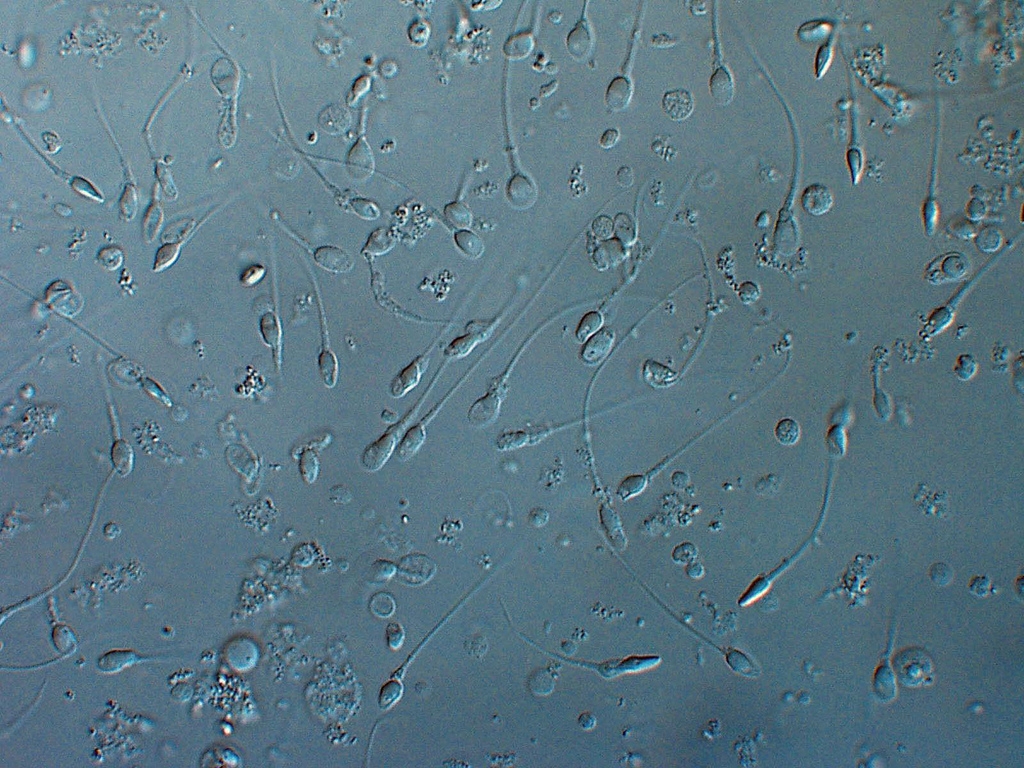 Acides Gras Essentiels et fertilité masculine